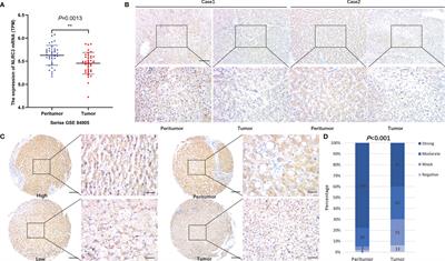 NLRC3 High Expression Represents a Novel Predictor for Positive Overall Survival Correlated With CCL5 and CXCL9 in HCC Patients